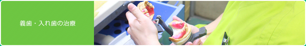 義歯・入れ歯の治療
