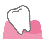 歯周病治療_イメージイラスト