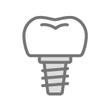 インプラント治療_イメージイラスト