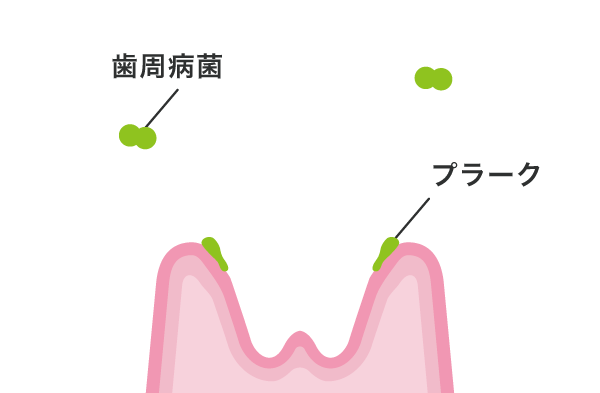 02:歯周病のはじまり